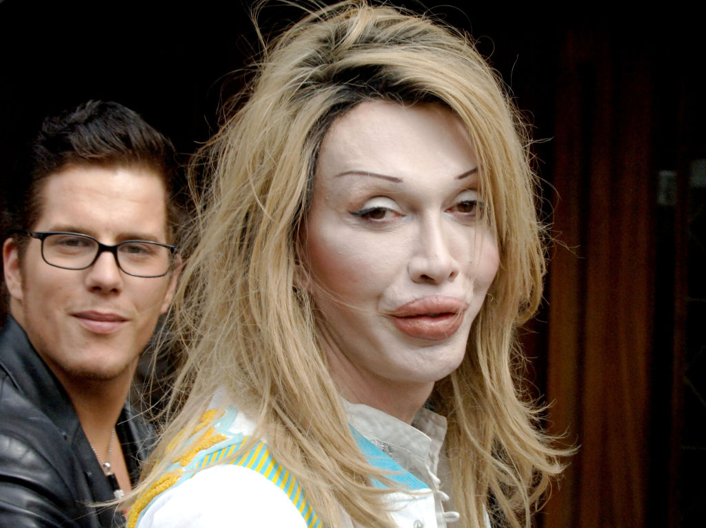 Celebrities with botched plastic surgery: The good, the bad and the scary