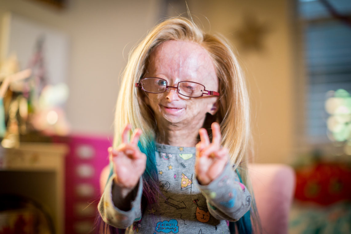 Progeria advocate Adalia Rose's death mourned by YouTube community