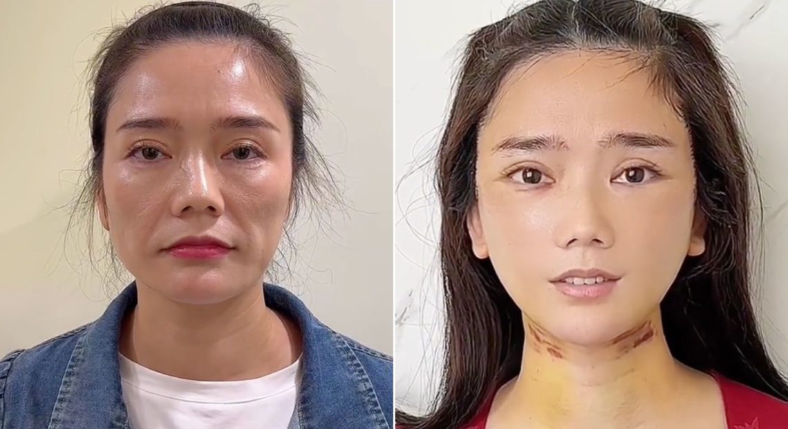 Plastic surgeon Dr. Kim goes viral on TikTok for dramatic before and